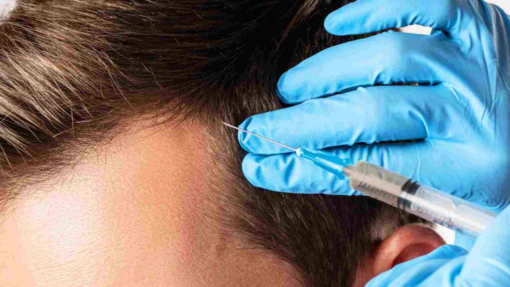 Say Goodbye to Hair Loss:  PRP for Hair Restoration at New Look Clinic