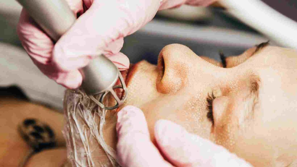 Unlocking the Secrets of Youthful Skin with CO2 Fractional Laser