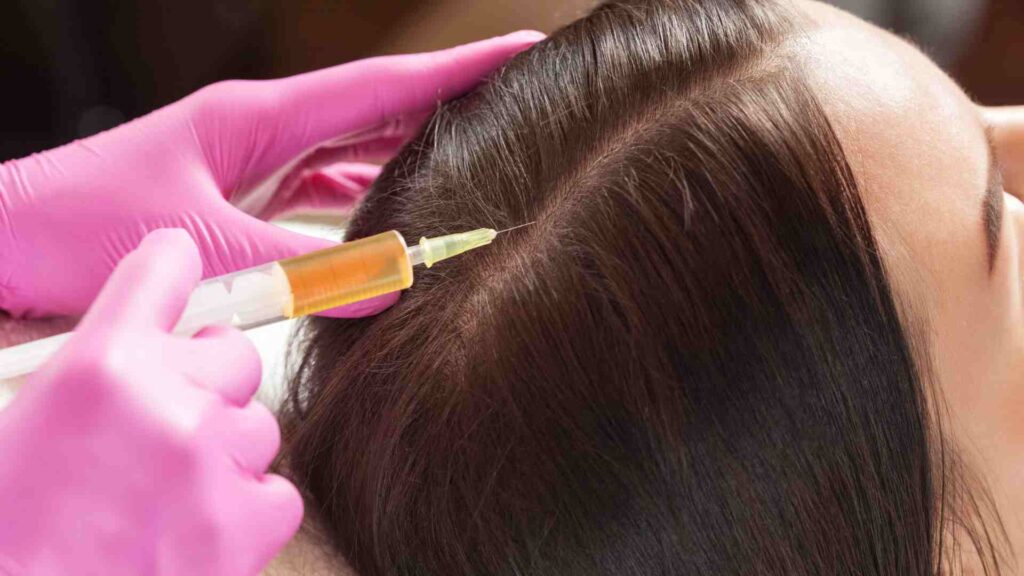 Why is PRP Advanced Hair re-growth Treatment gaining popularity and why is it the best option for Hair Re-growth today!
