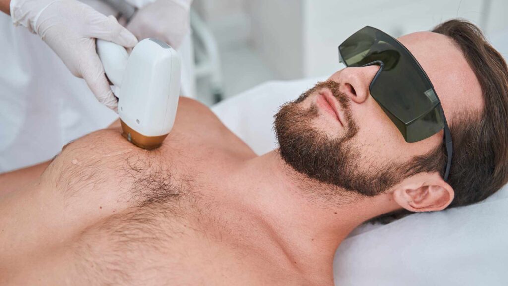The Ultimate Guide to Laser Hair Removal in Bangalore: What You Need to Know