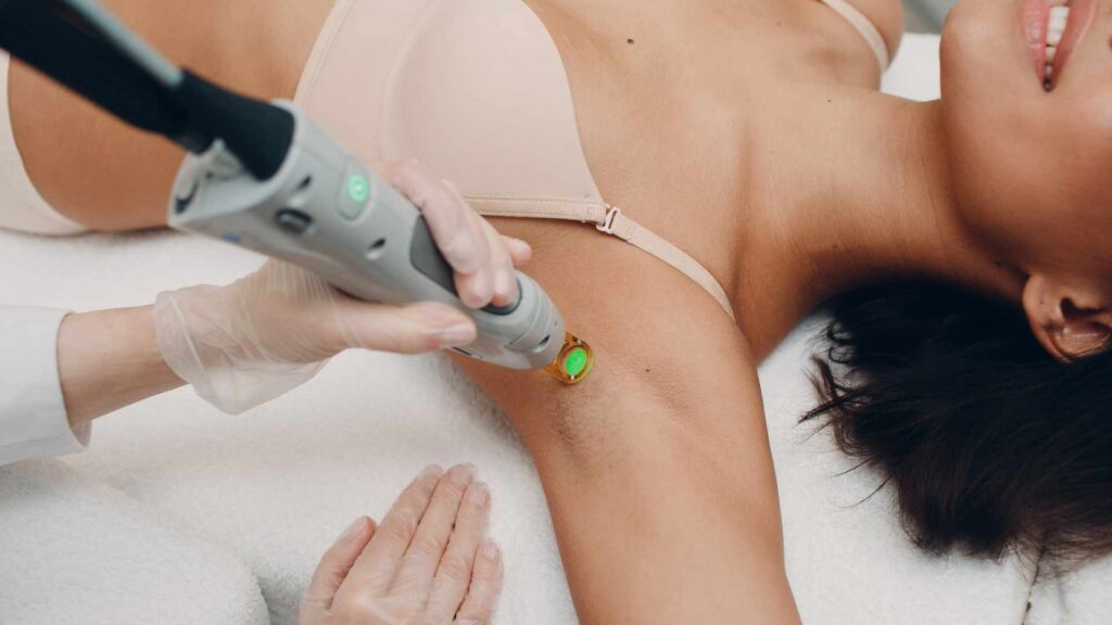 Laser Hair Removal: Say Goodbye to Shaving in Bangalore’s Humid Climate