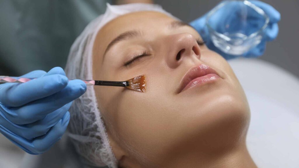 Peel Away Imperfections: The Magic of Chemical Peels at New Look Clinic, Frazer Town